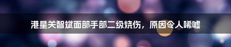 港星关智斌面部手部二级烧伤，原因令人唏嘘