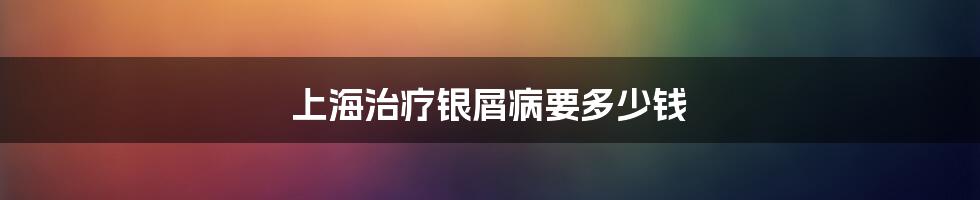 上海治疗银屑病要多少钱