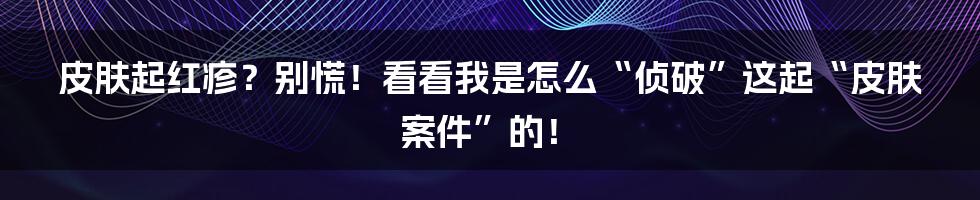 皮肤起红疹？别慌！看看我是怎么“侦破”这起“皮肤案件”的！